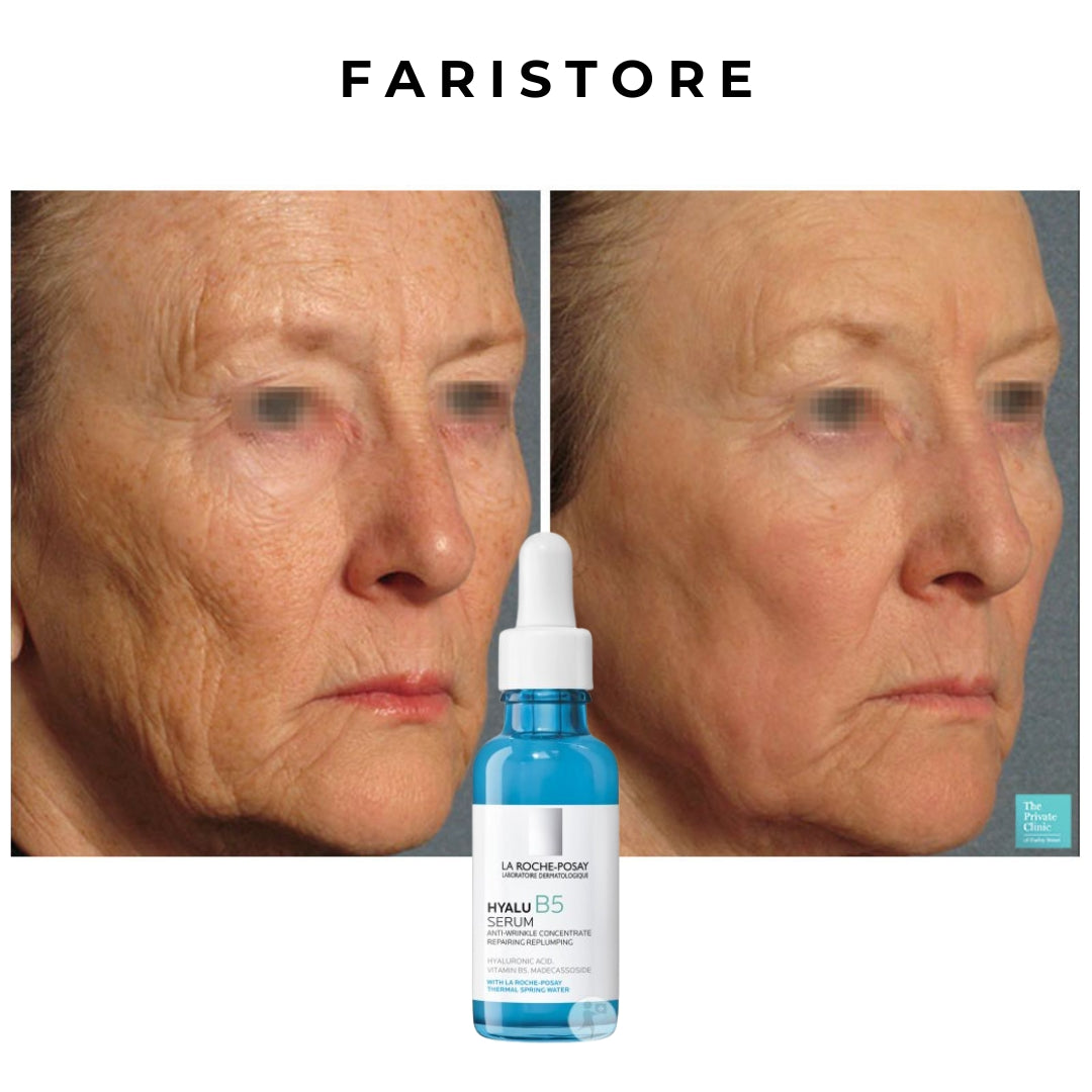 Skinlift® | Løft din hud, fjern rynker på ingen tid.